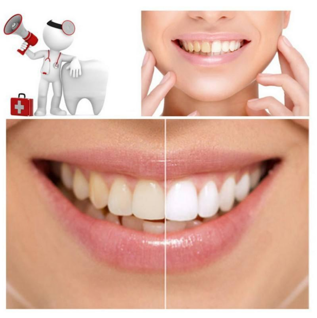 Vitabright Activated Charcoal Teeth Whitener