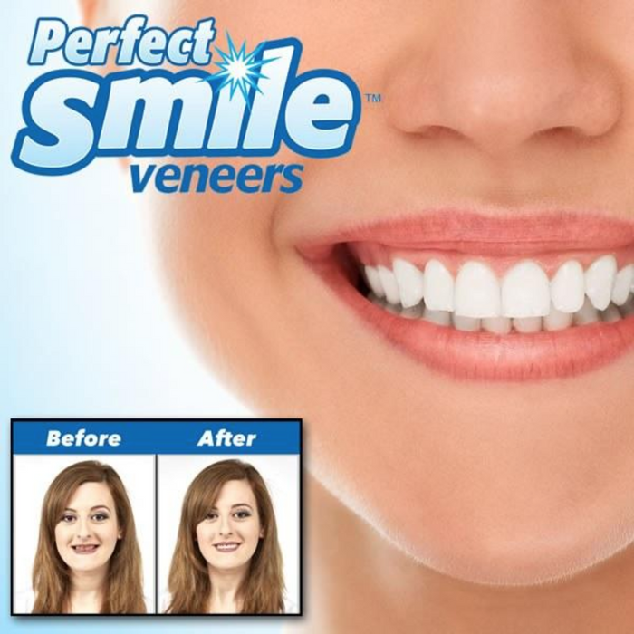 Instant Smile Veneers