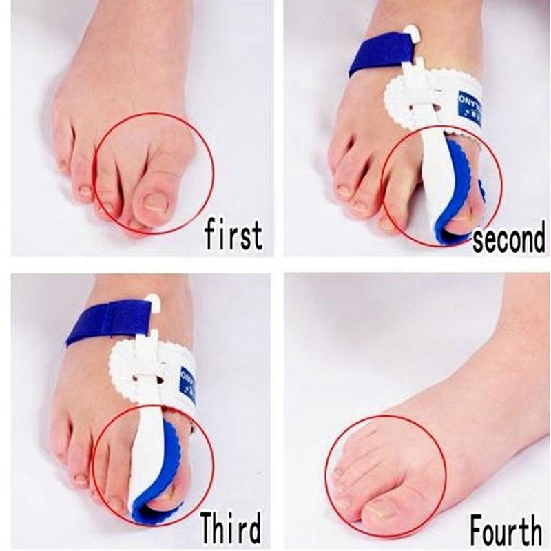 Bone Straight Bunion Relief Splint