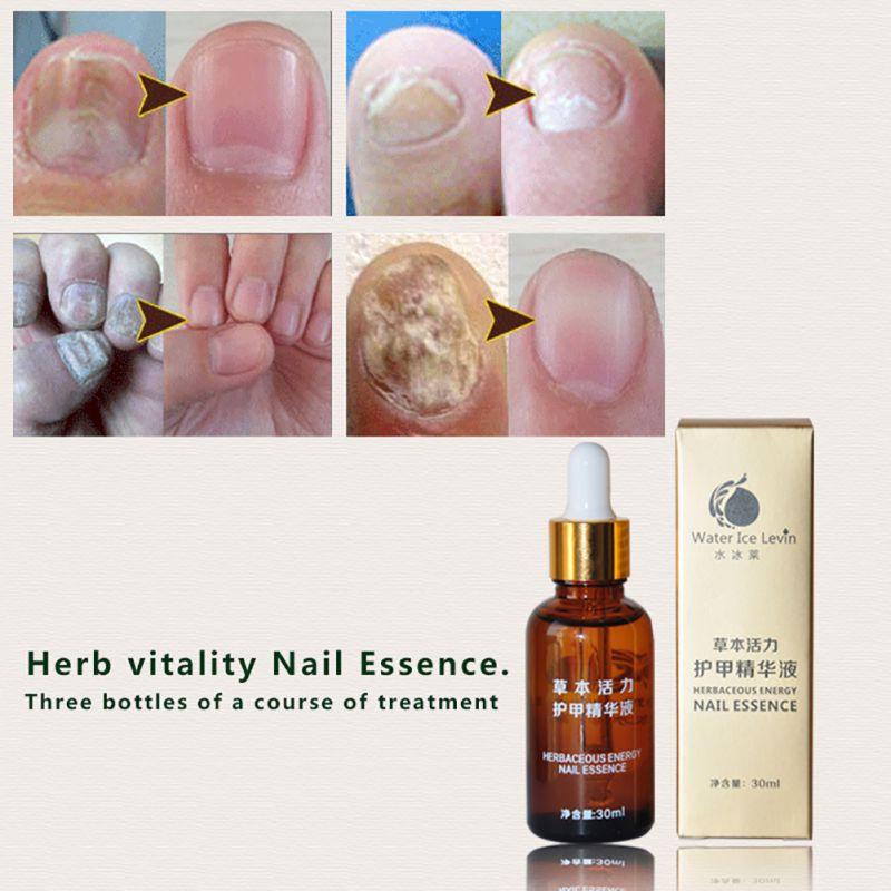 Revitanail Herbal Nail Repair