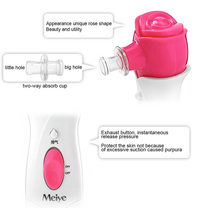 The Rose Blackhead Vacuum