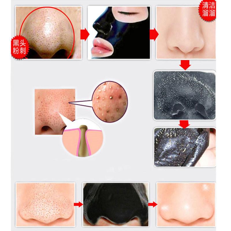 Pore Clear Blackhead Remover (20pcs)