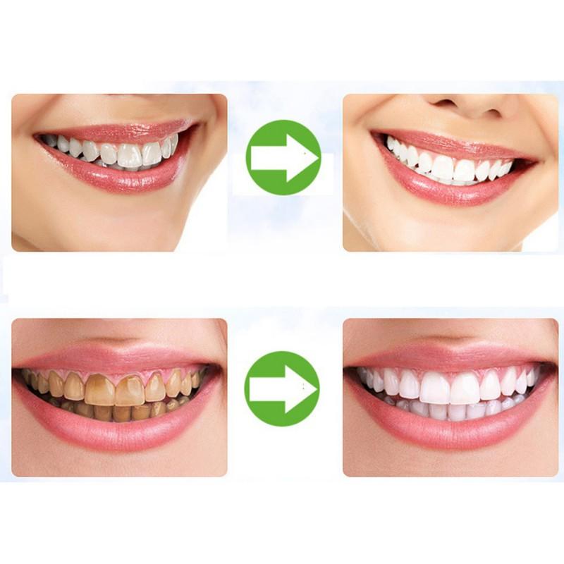 Vitabright Activated Charcoal Teeth Whitener