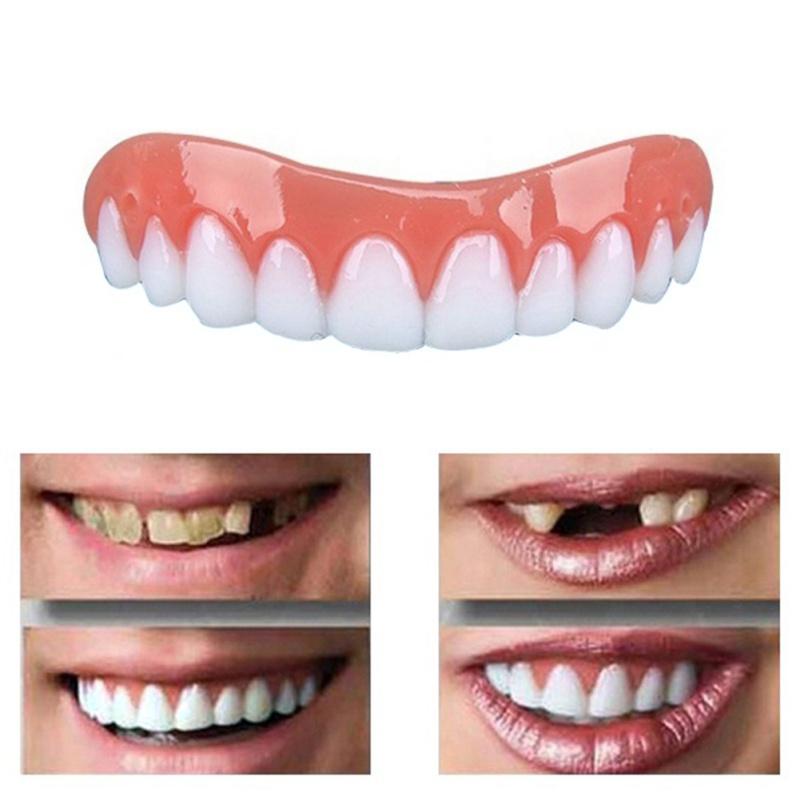 Instant Smile Veneers